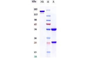 Anti-AXL / UFO Reference Antibody (tilvestamab) on SDS-PAGE under reducing (R) condition. (Recombinant AXL (Tilvestamab Biosimilar) antibody)