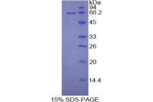 SDS-PAGE analysis of Rat MAP2 Protein. (MAP2 Protein)