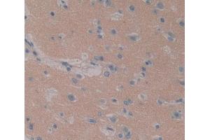IHC-P analysis of brain tissue, with DAB staining. (ITPA antibody  (AA 3-180))