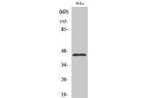 Western Blotting (WB) image for anti-Potassium Inwardly-Rectifying Channel, Subfamily J, Member 11 (KCNJ11) (Ser688) antibody (ABIN3180137)