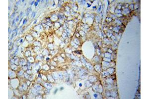 Immunohistochemistry (IHC) image for anti-ATG5 Autophagy Related 5 (ATG5) (AA 1-275) antibody (ABIN3020674) (ATG5 antibody  (AA 1-275))