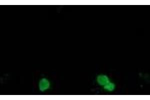 Image no. 1 for anti-Synovial Sarcoma, X Breakpoint 1 (SSX1) antibody (ABIN1501158) (SSX1 antibody)