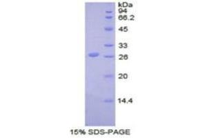 SDS-PAGE (SDS) image for Ubiquitin Carboxyl-terminal Hydrolase L5 (UCHL5) (AA 27-246) protein (His tag) (ABIN2122302)