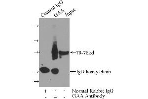 IP analysis of mouse liver tissue lysate (4000 μg), using GAA antibody (4 μg, 1/600 dilution). (GAA antibody)