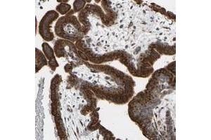 Immunohistochemical staining of human placenta with YIPF2 polyclonal antibody  shows strong cytoplasmic positivity in trophoblastic at 1:50-1:200 dilution.
