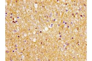 Immunohistochemistry of paraffin-embedded human brain tissue using ABIN7152234 at dilution of 1:100 (SLC1A2 antibody  (AA 460-574))