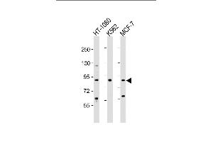 All lanes : Anti-TBK Antibody  at 1:2000 dilution Lane 1: HT-1080 whole cell lysate Lane 2: K562 whole cell lysate Lane 3: MCF-7 whole cell lysate Lysates/proteins at 20 μg per lane.
