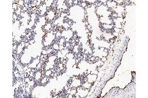 Immunohistochemistry analysis of paraffin-embedded Rat lung using VWF Polyclonal Antibody at dilution of 1:500. (VWF antibody)