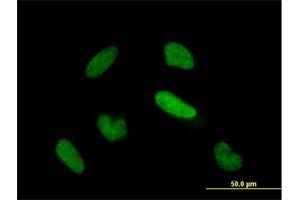 Immunofluorescence of purified MaxPab antibody to TIAL1 on HeLa cell. (TIAL1 antibody  (AA 1-252))