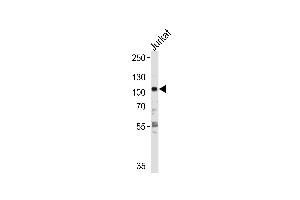 HK2 Antibody  f western blot analysis in Jurkat cell line lysates (35 μg/lane). (Hexokinase 2 antibody  (AA 453-483))