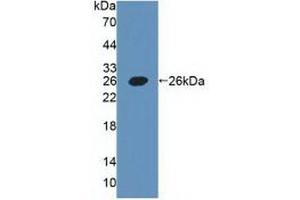 Detection of Recombinant PDPN, Human using Polyclonal Antibody to Podoplanin (PDPN) (Podoplanin antibody  (AA 23-143))
