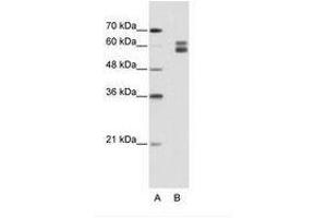 Image no. 1 for anti-Mismatch Repair Protein 2 (MSH2) (AA 151-200) antibody (ABIN203217) (MSH2 antibody  (AA 151-200))