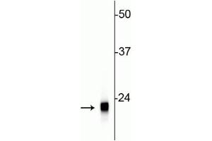 Western blot of rat cerebellar lysate showing specific immunolabeling of the ~22 kDa VSNL1 protein. (VSNL1 antibody)