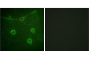 Immunofluorescence analysis of NIH-3T3 cells, using Trk A (Phospho-Tyr496) Antibody. (TRKA antibody  (pTyr496))