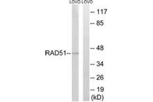 Western blot analysis of extracts from LOVO cells, using RAD51 (Ab-315) Antibody. (RAD51 antibody  (AA 281-330))