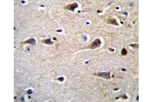 CRFR2D antibody immunohistochemistry analysis in formalin fixed and paraffin embedded human brain tissue. (CRFR2D antibody)