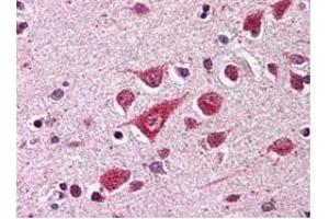 Anti-PPCA Antibody - Immunohistochemistry  Anti-PPCA antibody was diluted 1:500 to detect PPCA in human brain cortex tissue. (CTSA antibody)