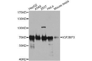 Western blot analysis of extracts of various cell lines, using IGF2BP3 antibody. (IGF2BP3 antibody  (AA 300-579))