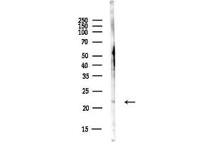 anti-Poly(A) Binding Protein, Cytoplasmic 1-Like 2A (PABPC1L2A) antibody