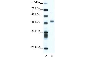 WB Suggested Anti-FLI1 Antibody Titration:  1. (FLI1 antibody  (N-Term))