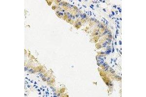 Immunohistochemical analysis of PYGL staining in mouse lung formalin fixed paraffin embedded tissue section.