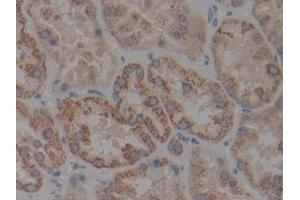 Detection of IkBb in Human Kidney Tissue using Polyclonal Antibody to Inhibitory Subunit Of NF Kappa B Beta (IkBb) (Inhibitory Subunit of NF kappa B beta (AA 85-332) antibody)