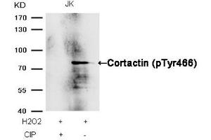 Western blot analysis of extracts from JK cells, treated with H2O2 or calf intestinal phosphatase (CIP), using Cortactin (Phospho-Tyr466) Antibody. (Cortactin antibody  (pTyr466))