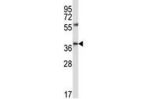 CD33 antibody western blot analysis in NCI-H460 lysate (CD33 antibody  (AA 88-117))