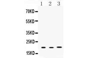 Western blot analysis of Anterior Gradient 2 expression in rat lung extract ( Lane 1), mouse liver extract ( Lane 2) and MCF-7 whole cell lysates ( Lane 3).