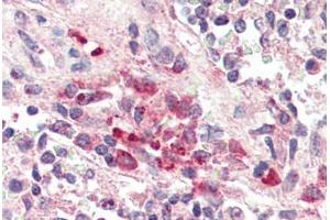 Human Spleen, Macrophages (formalin-fixed, paraffin-embedded) stained with TREM2 antibody ABIN337127 at 2. (TREM2 antibody  (AA 199-212))