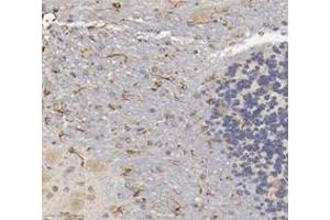 Immunohistochemistry analysis of paraffin-embedded mouse brain using,CHERP (ABIN7073277) at dilution of 1: 3600 (CHERP antibody)