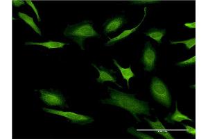 Immunofluorescence of monoclonal antibody to CASP10 on HeLa cell. (Caspase 10 antibody  (AA 19-187))