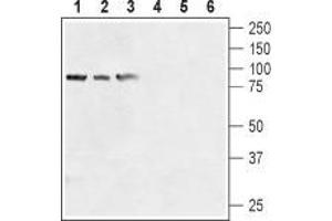 Western blot analysis of human prostate carcinoma cell lines (LNCaP (lanes 1 and 4), DU145 (lanes 2 and 5), PC-3 (lanes 3 and 6) lysates: - 1-3. (TRPV6 antibody  (1st Extracellular Loop))