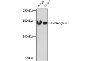 Western blot analysis of extracts of various cell lines, using Desmoglein 3 Rabbit mAb (ABIN7266741) at 1:1000 dilution. (Desmoglein 3 antibody)