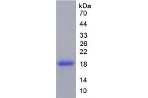 SDS-PAGE of Protein Standard from the Kit  (Highly purified E. (TNC ELISA Kit)