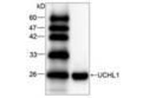 Image no. 1 for anti-Ubiquitin Carboxyl-terminal Esterase L1 (Ubiquitin Thiolesterase) (UCHL1) antibody (ABIN791511)