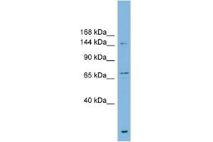 WB Suggested Anti-ABCB1 Antibody Titration:  0. (ABCB1 antibody  (Middle Region))