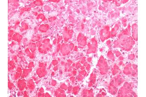 Human Adrenal: Formalin-Fixed, Paraffin-Embedded (FFPE) (G Protein-Coupled Receptor 133 antibody  (C-Term))