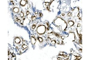 IHC analysis of CD146/MCAM using anti-CD146/MCAM antibody (ABIN7602098). (MCAM antibody  (AA 59-401))