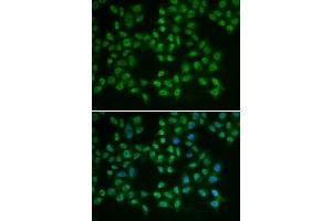 Immunofluorescence analysis of HeLa cells using BTK antibody (ABIN5970757). (BTK antibody)