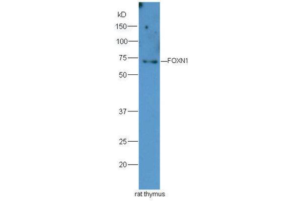 FOXN1 antibody  (AA 321-420)