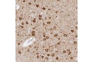 Immunohistochemical staining of human cerebral cortex with C9orf50 polyclonal antibody  shows strong cytoplasmic positivity in neurons.