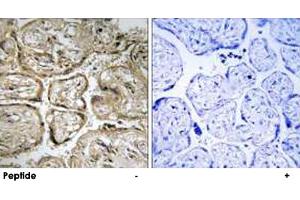 Immunohistochemistry analysis of paraffin-embedded human placenta tissue using CST9L polyclonal antibody . (CST9L antibody)