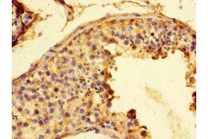 Immunohistochemistry of paraffin-embedded human testis tissue using ABIN7153916 at dilution of 1:100 (Glucose-6-Phosphate Dehydrogenase antibody  (AA 80-185))
