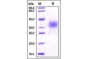 Human B7-H5, His Tag on SDS-PAGE under reducing (R) condition. (VTCN1 Protein (AA 33-194) (His tag))
