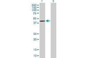 Western Blot analysis of SCCPDH expression in transfected 293T cell line by SCCPDH MaxPab polyclonal antibody. (SCCPDH antibody  (AA 1-429))