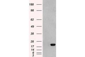 HEK293T cells were transfected with the pCMV6-ENTRY control (Left lane) or pCMV6-ENTRY AK1 (Right lane) cDNA for 48 hrs and lysed. (Adenylate Kinase 1 antibody)