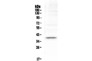 Western blot analysis of Tal1 using anti-Tal1 antibody . (TAL1 antibody  (AA 174-259))