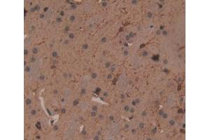 IHC-P analysis of Mouse Tissue, with DAB staining. (Fascin antibody  (AA 27-273))