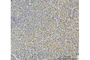 IHC analysis of CA1 using anti-CA1 antibody (ABIN3043766). (CA1 antibody  (AA 9-261))